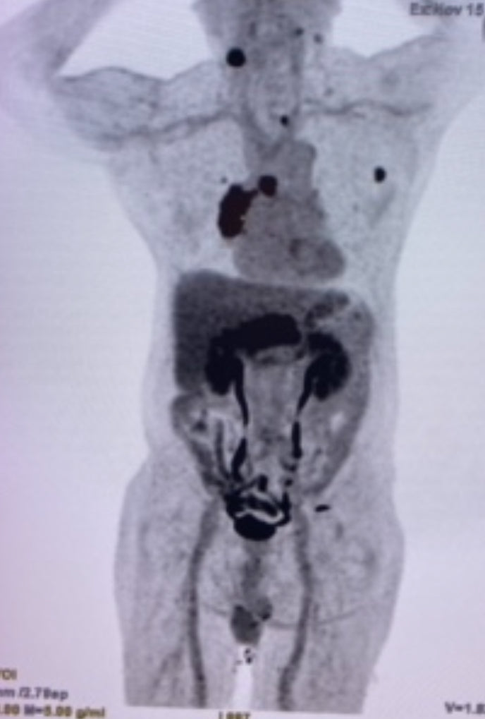 39 Winnie Chan Sze Wun